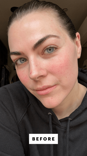 Dall'Asen before applying the Jones Road The Neutralizer Pencil